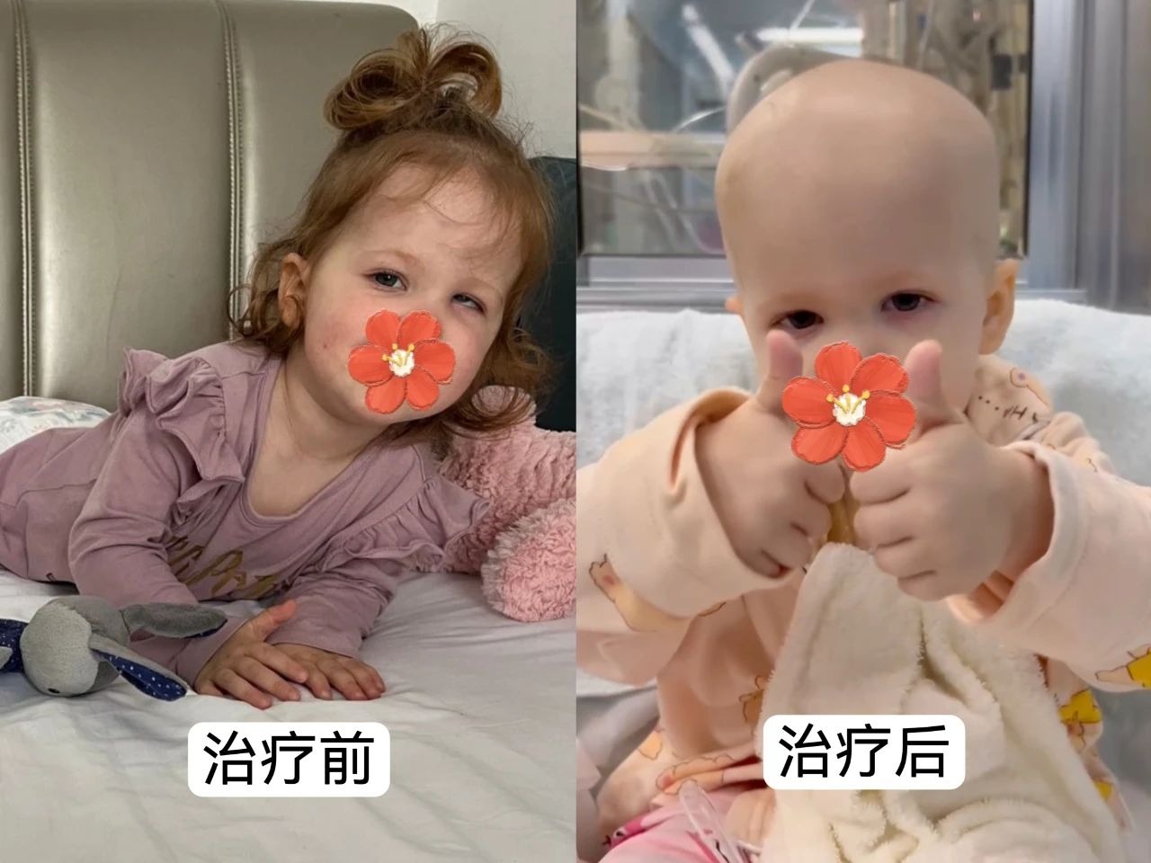 “你们创造了奇迹!”——瑞典罕见遗传病患儿万里赴粤基因治疗获得新生